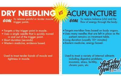 what is dry needling used for