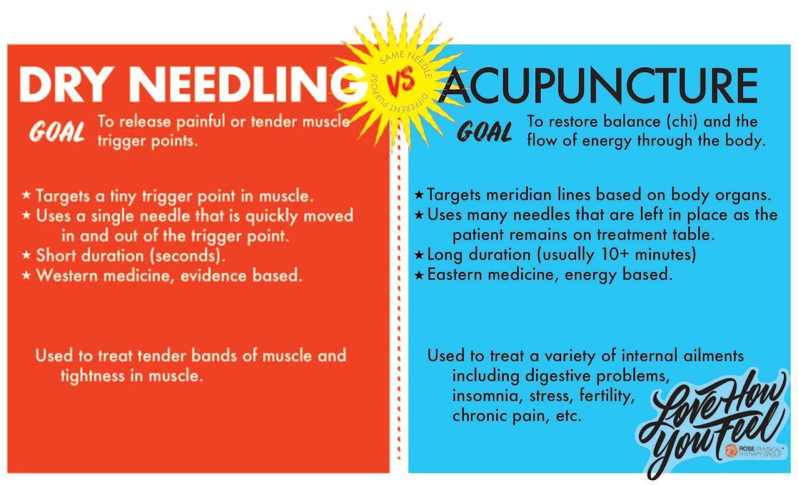 what is dry needling used for
