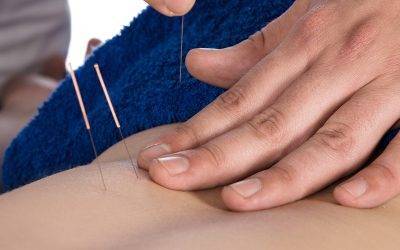 how does dry needling therapy work