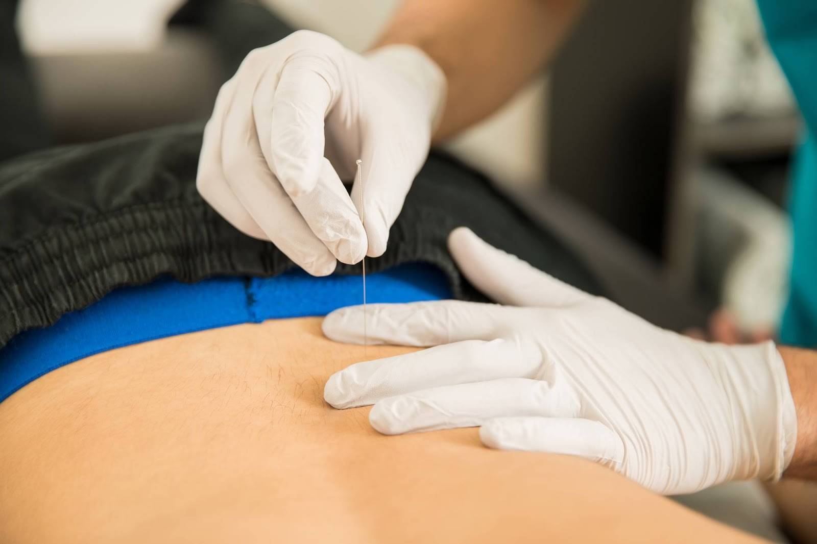how does dry needling help