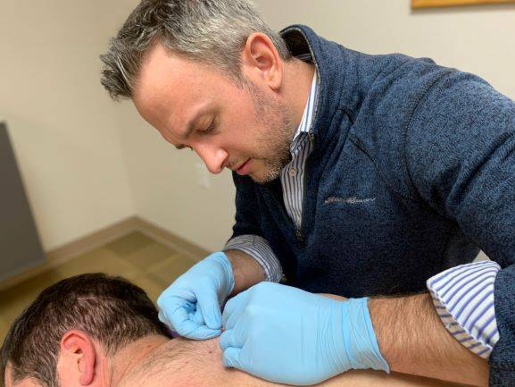 how often dry needling