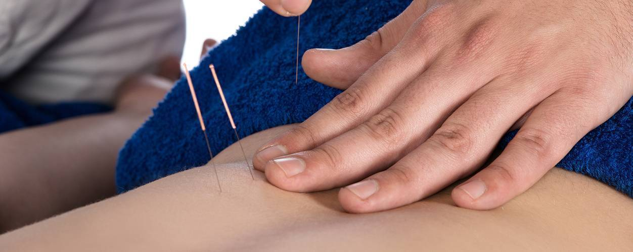 download-2025-12-03T192416.592 how does dry needling therapy work