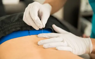 how does dry needling help